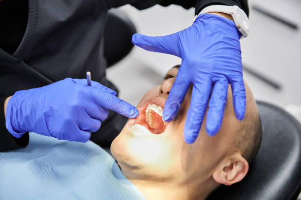 Best Root Canal Emergency Dentist  in Hardeeville, SC